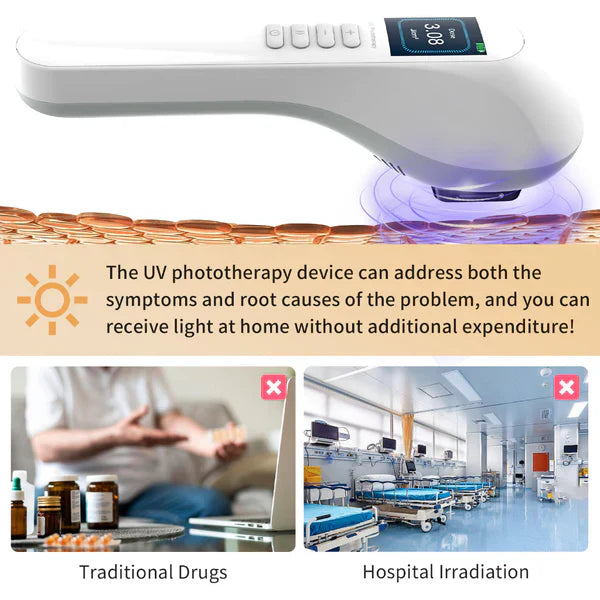 KTS Handheld UVB Vitiligo/Psoriasis Light Therapy Device