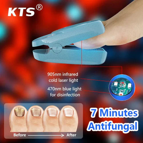 KTS® New Onychomycosis Laser Treatment Device