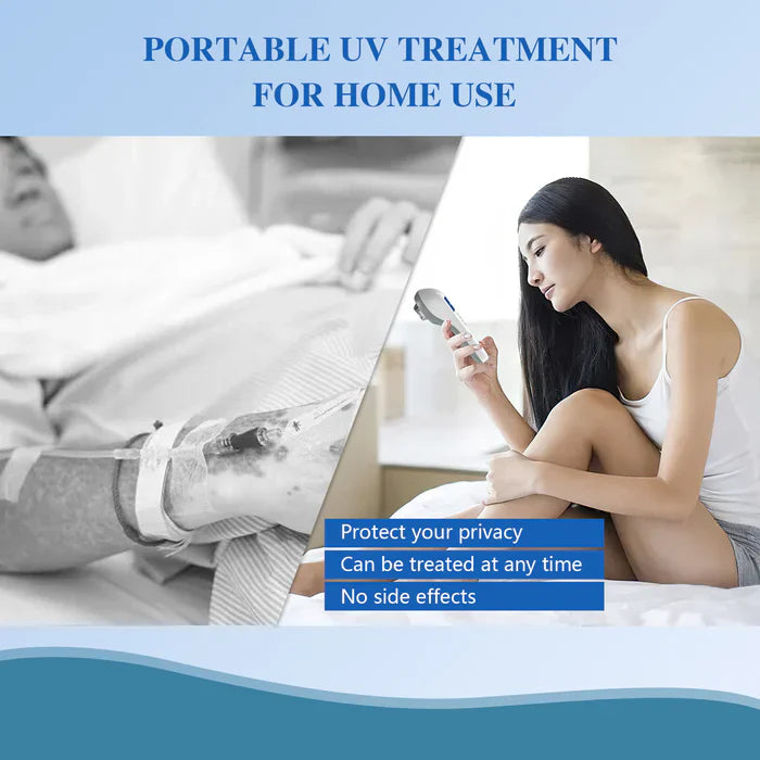 KTS Handheld UVB Vitiligo/Psoriasis Light Therapy Device