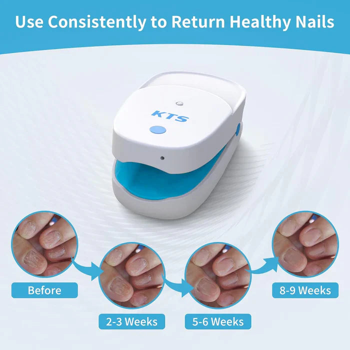 KTS® Nail Fungus Laser Treatment Device