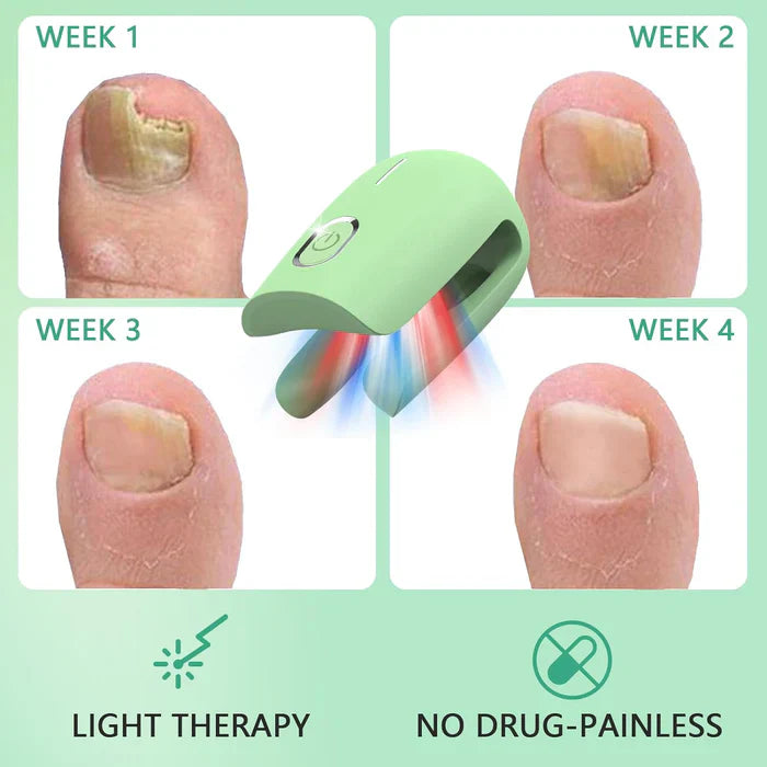 KTS® Nail Fungus Laser Therapy Device