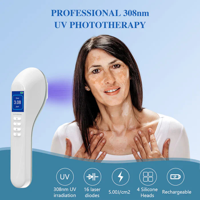 KTS Handheld UVB Vitiligo/Psoriasis Light Therapy Device