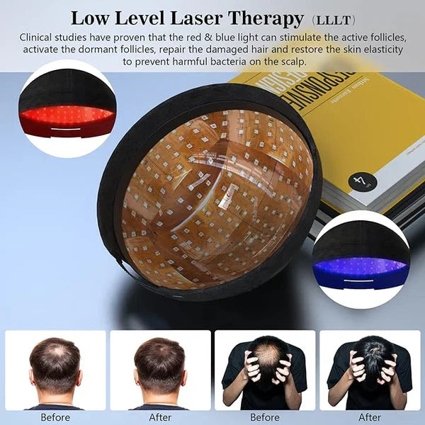 KTS® Laser Hair Regrowth Cap