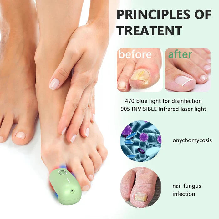 KTS® Nail Fungus Cleaning Device for Onychomycosis