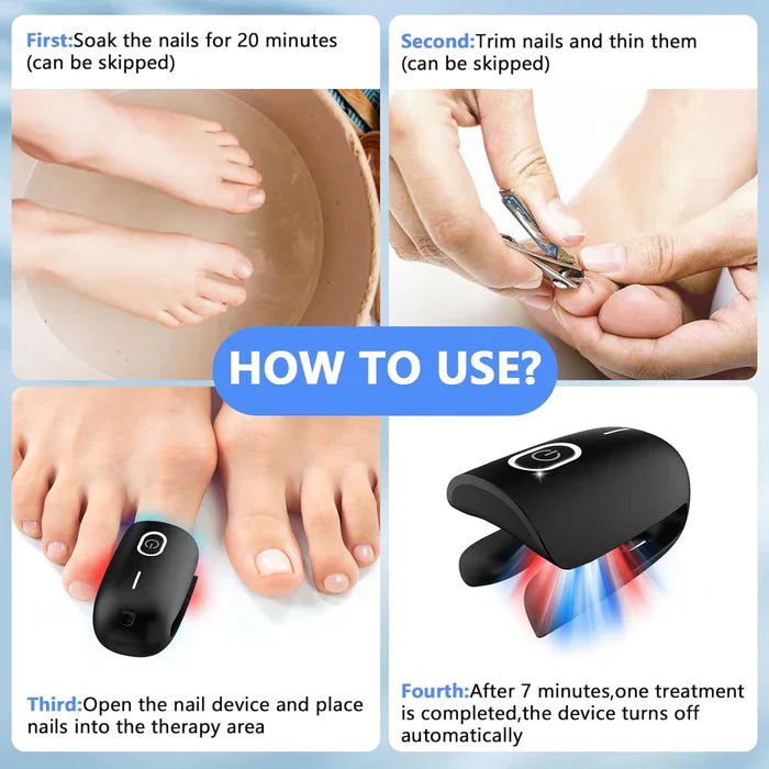 KTS® Nail Fungus Cleaning Device for Onychomycosis