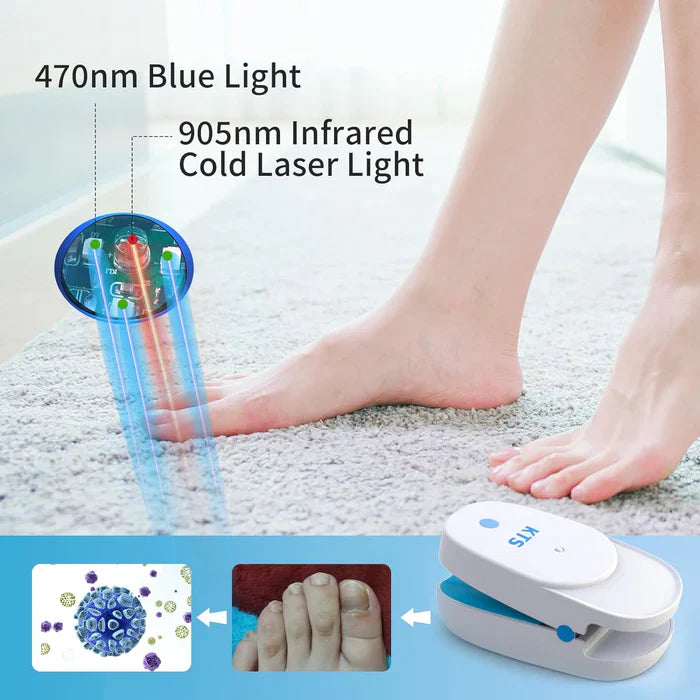 KTS® Nail Fungus Laser Treatment Device