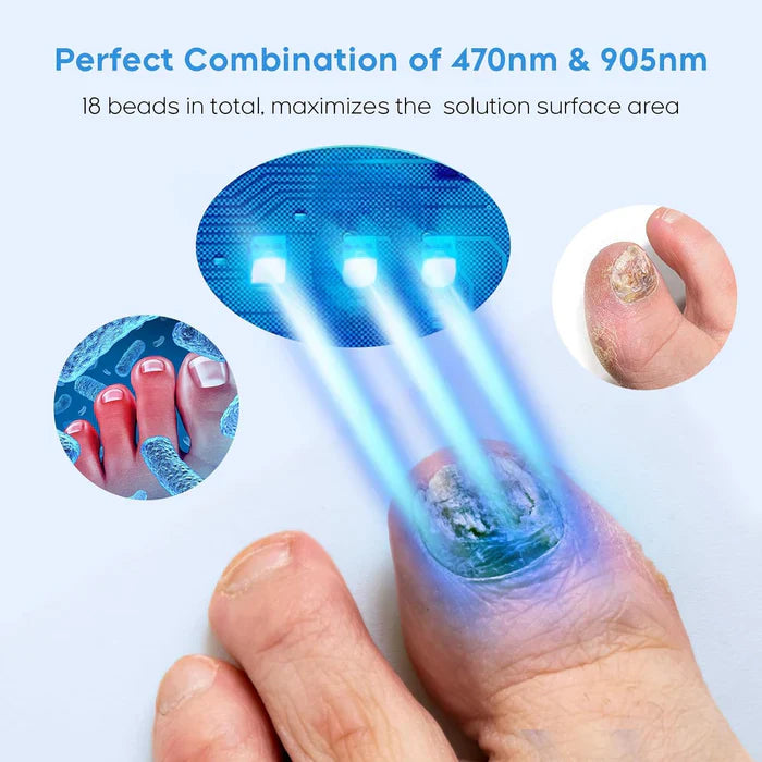 Nail Fungus Light for Multiple Toenail