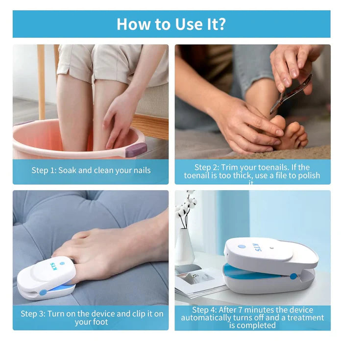 KTS® Nail Fungus Laser Treatment Device