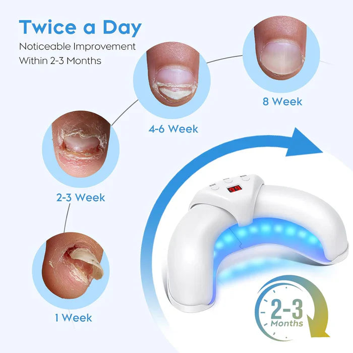 Nail Fungus Light for Multiple Toenail