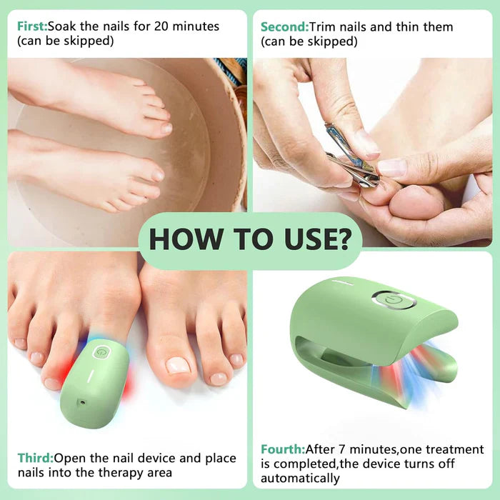 KTS® Nail Fungus Cleaning Device for Onychomycosis