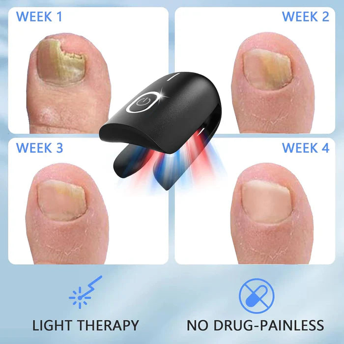 KTS® Nail Fungus Cleaning Device for Onychomycosis