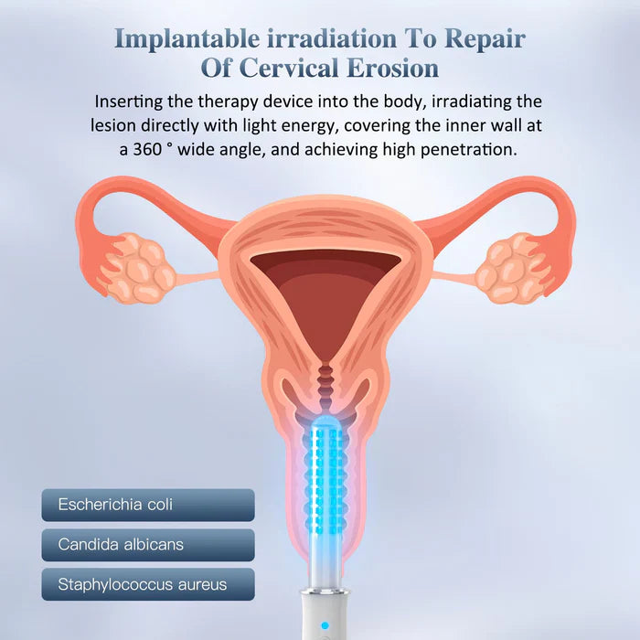 KTS® Portable Vaginal Rejuvenation Wand