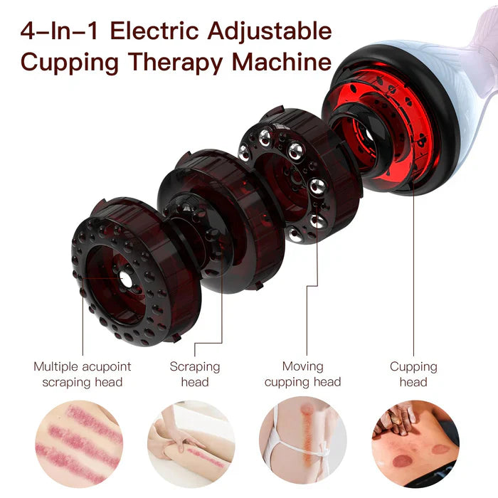 KTS® Electric Cupping Treatment