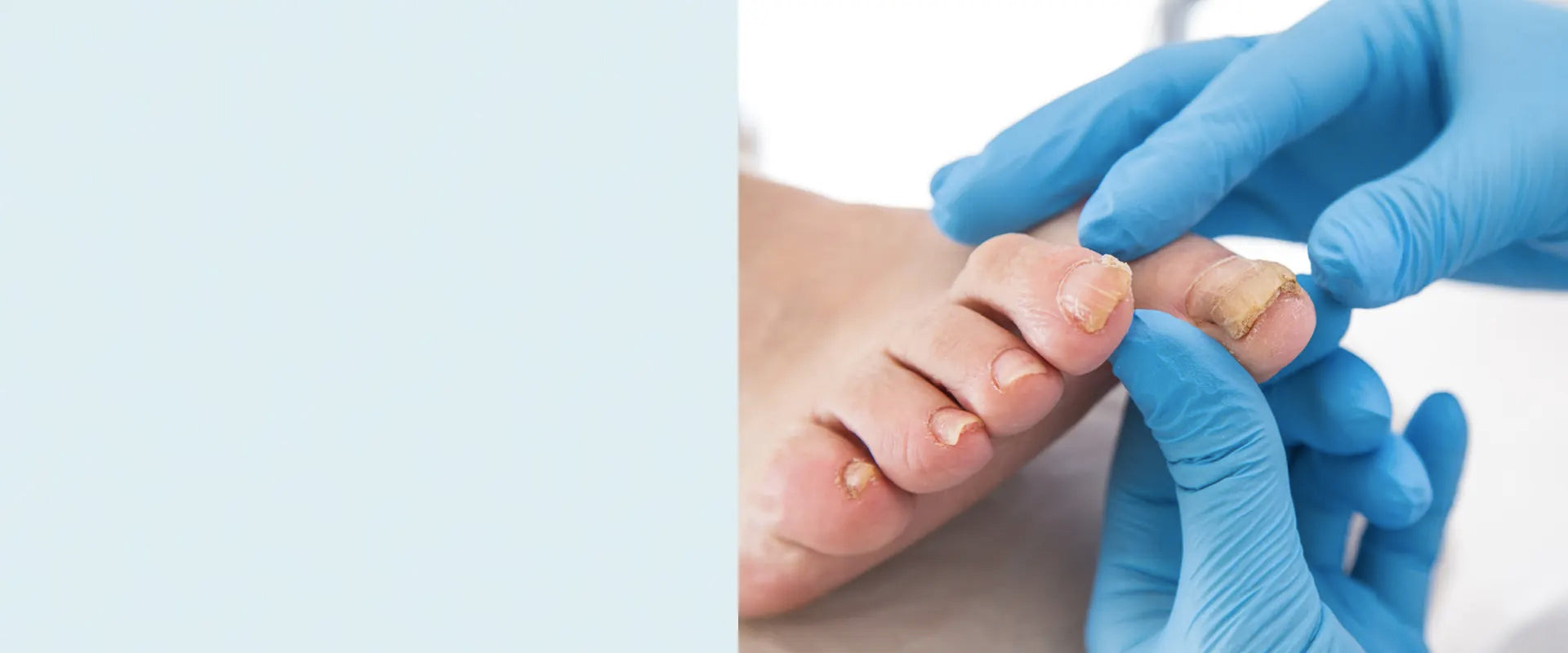 At Home Laser Treatment For Toenail Fungus KTS Laser Treatment for Toenail Fungus, Home Laser Therapy Device